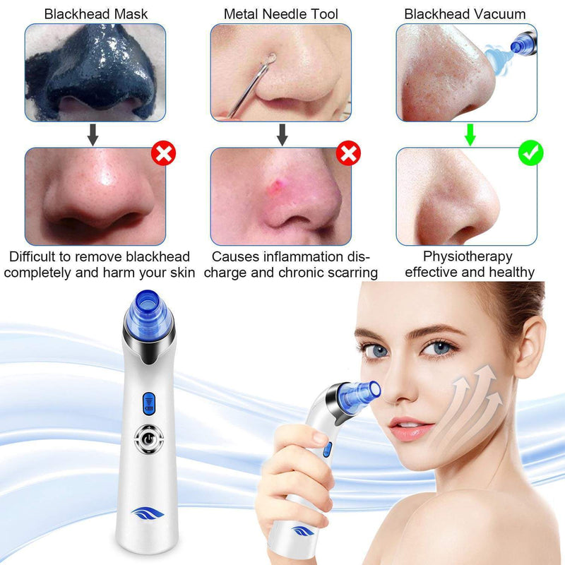 2020 Blackhead Remover Vacuum Tool