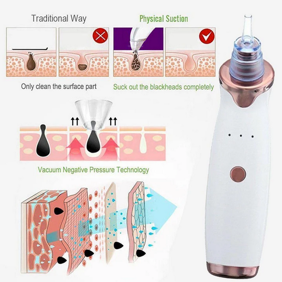 Blackhead Remover Pore Cleaner Extractor