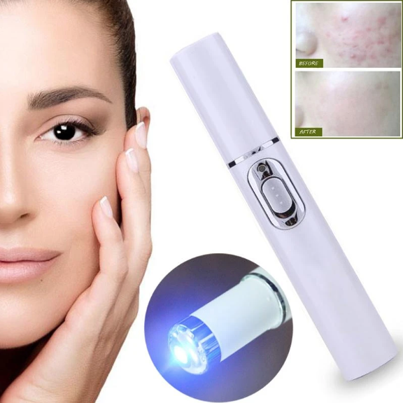 Blue Light Therapy Pen For Acne & Spider Veins