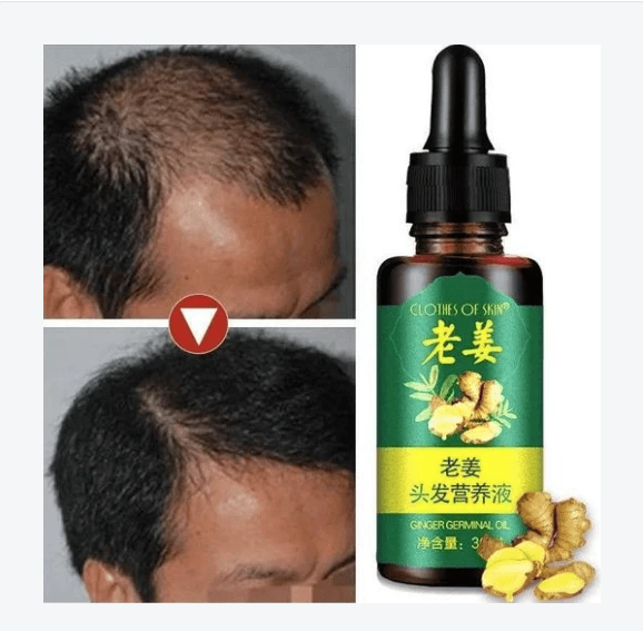 Hair Regrow Oil - Hair Regrowth Serum in 7 Days With Ginger