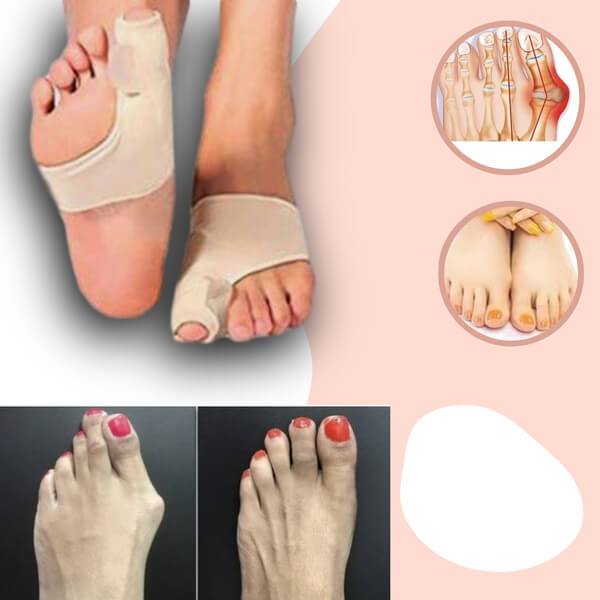 Orthopedic Toe Bunion Corrector  - 1 Pair (Left + Right)