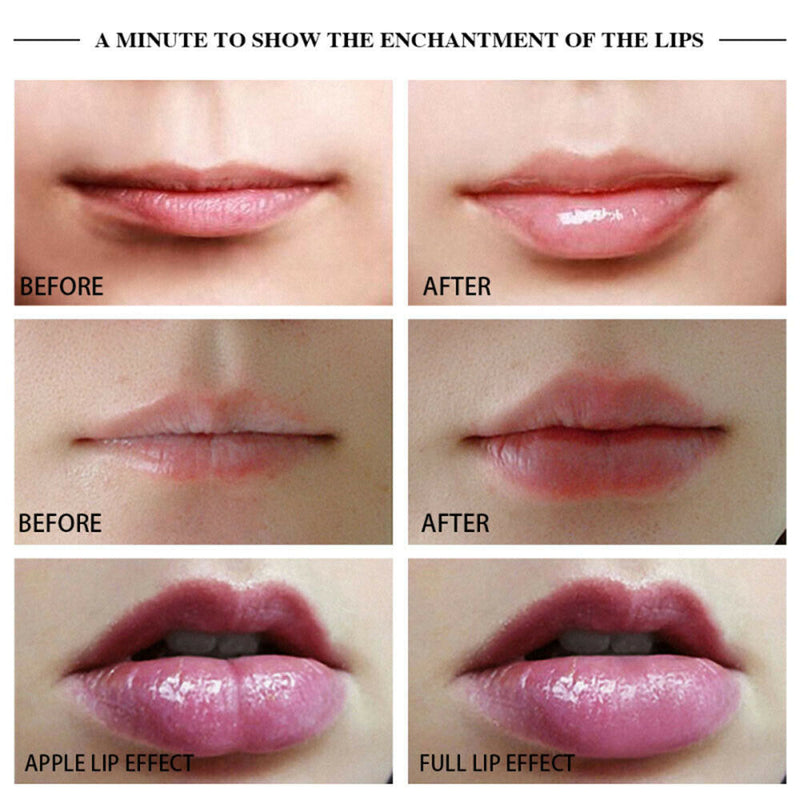 Quick Natural Automatic Lip Plumper Device Lip Enhancer