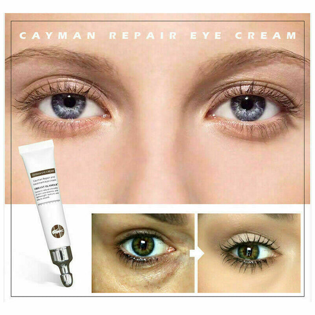 Magic Eye Cream-28 seconds to remove bags under eyes / dark circles / eye wrinkles