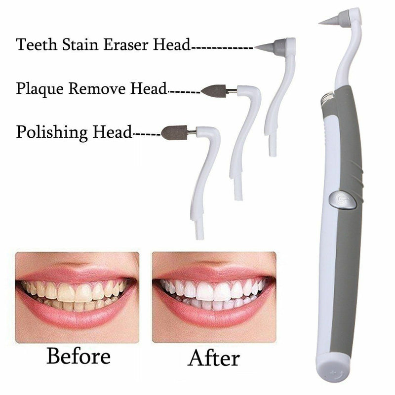 Ultrasonic Teeth Stain Eraser Plaque Remover Teeth Whitening